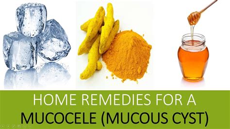 Use a mixture of oil to coat the cotton and rub it into the cyst. . Mucous cyst lip treatment at home